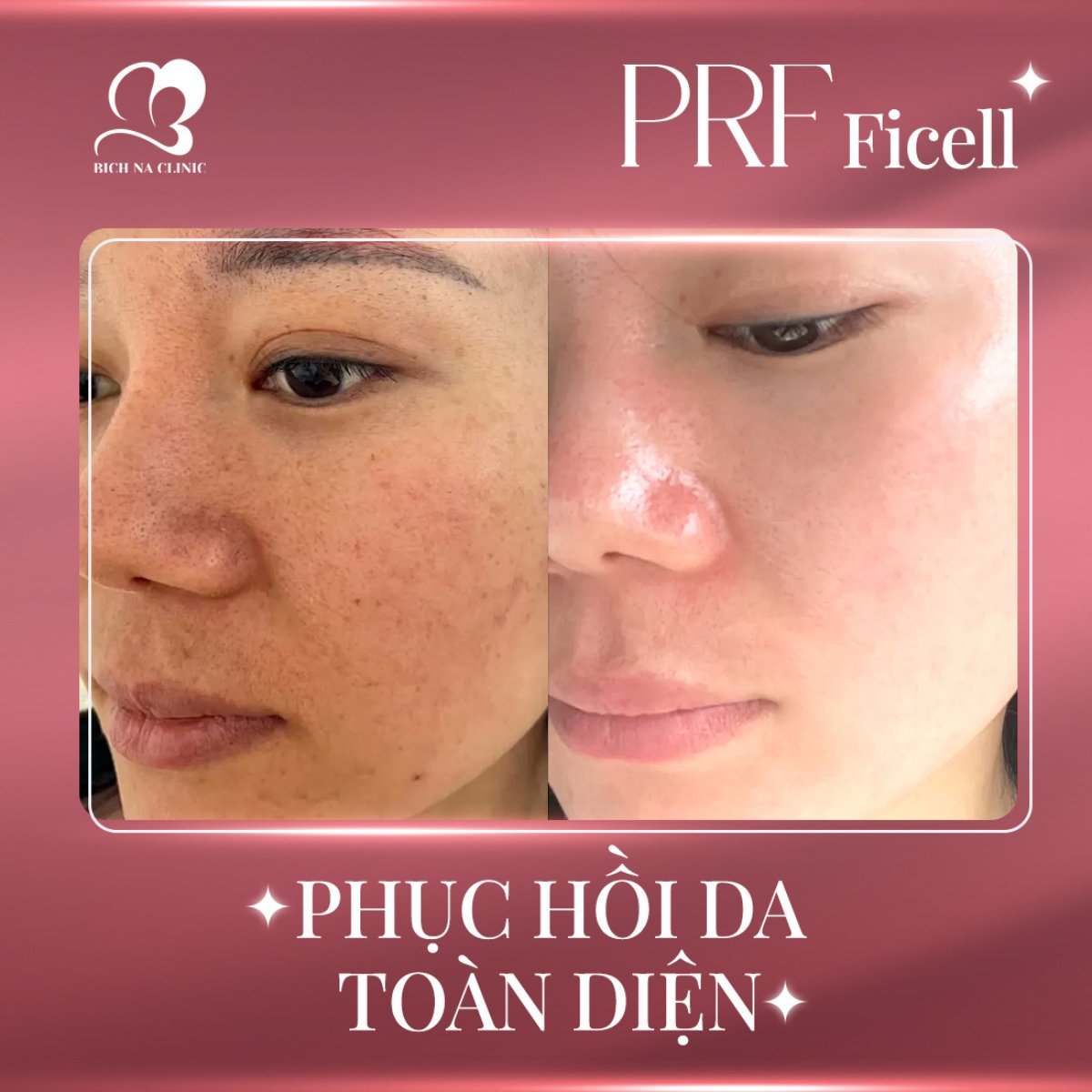 ĐỊA CHỈ TRẺ HÓA DA CHẤT LƯỢNG CAO Ở TP HCM ĐƯỢC NHIỀU NGƯỜI TIN CHỌN