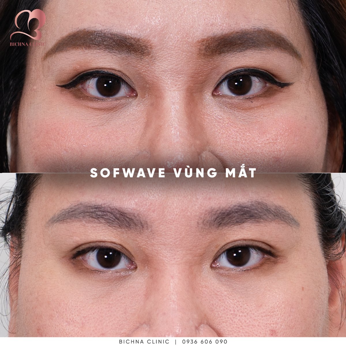CÁC BƯỚC CHỐNG LÃO HÓA MẮT HIỆU QUẢ TỪ THÓI QUEN HÀNG NGÀY
