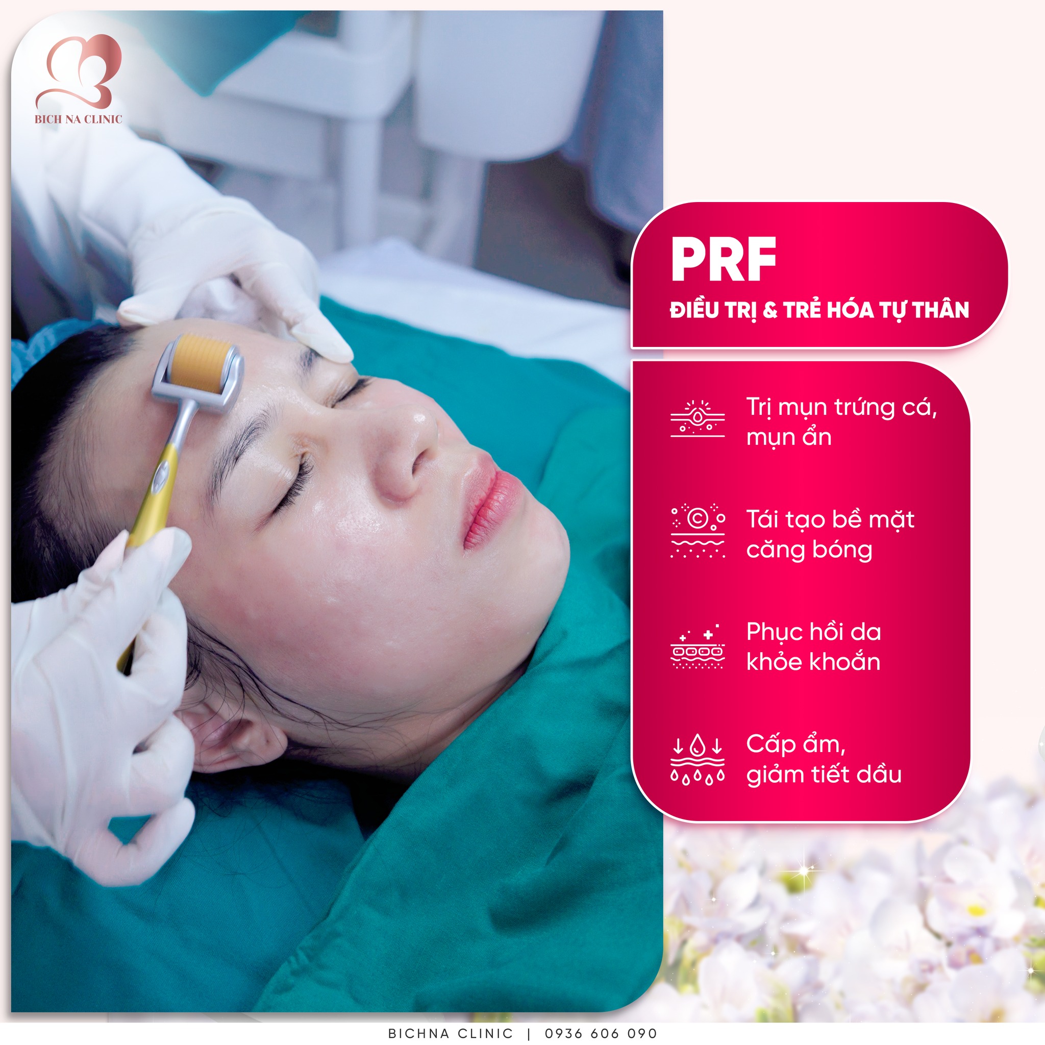 Liệu trình PRF điều trị mụn, trẻ hóa tự thân và phục hồi da khỏe mạnh tại BichNa Clinic