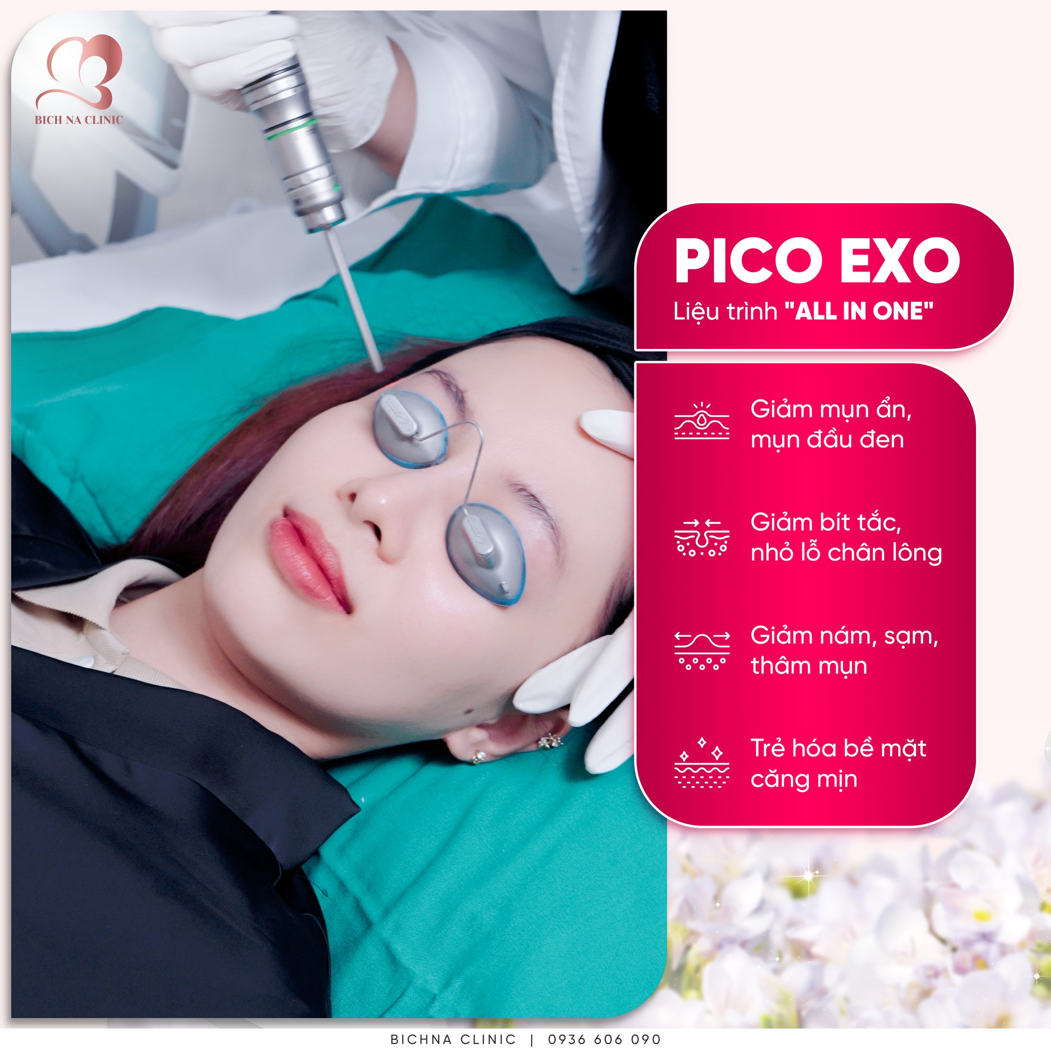 Liệu trình Pico Exo điều trị mụn ẩn, mờ thâm nám và trẻ hóa da tại BichNa Clinic