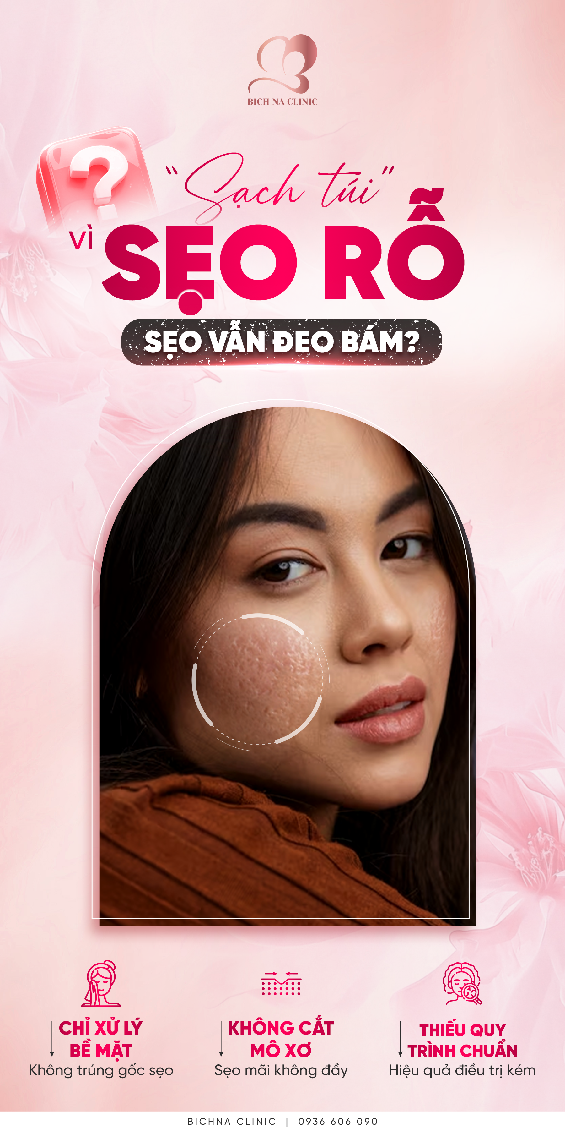 Minh họa các nguyên nhân khiến điều trị sẹo rỗ chưa hiệu quả như chỉ xử lý bề mặt, không cắt mô xơ và thiếu quy trình điều trị chuẩn.