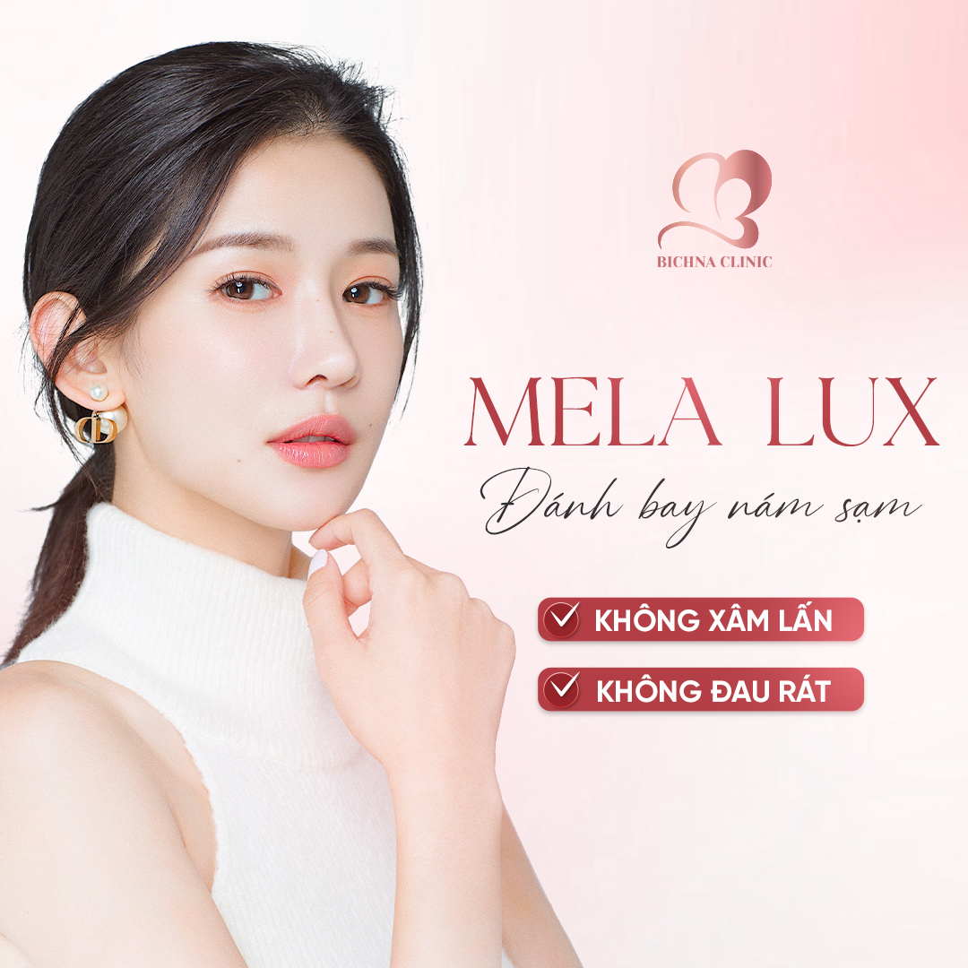 trị nám da mặt bằng công nghệ cao